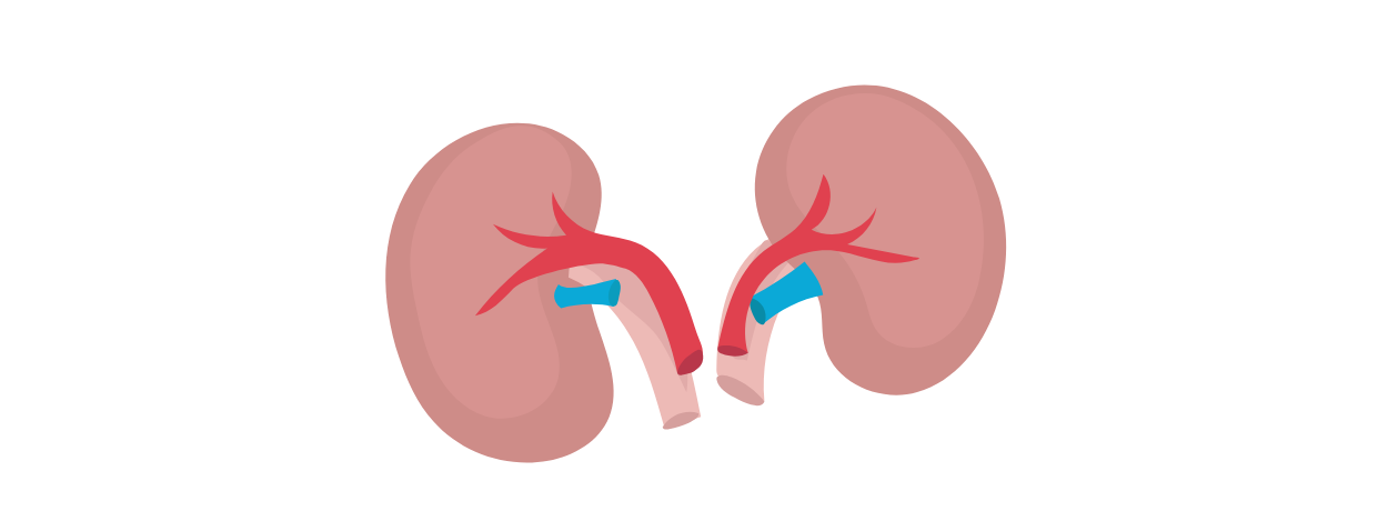 Kidney Transplant